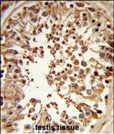 Rabbit Polyclonal Antibody to DMC1 (N-term)