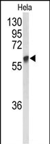 GALNT2 (N-term)