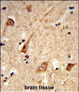 Rabbit Polyclonal Antibody to GALNT2 (N-term)