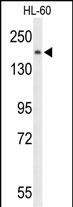 PLCB1