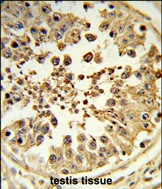 Rabbit Polyclonal Antibody to DIAPH2