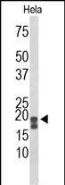 ACP1 (N-term)