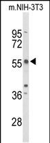 TAC2N (N-term)