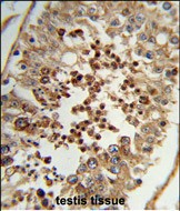 Rabbit Polyclonal Antibody to TAC2N (N-term)