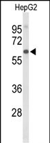 AFM (N-term)