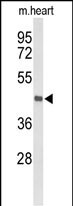 DBC1 (N-term)