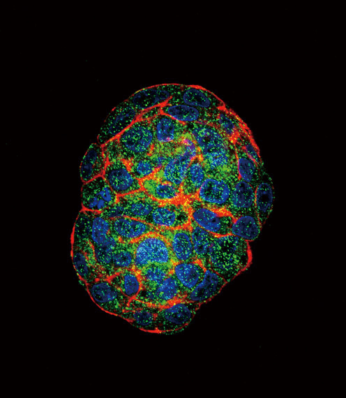 Rabbit Polyclonal Antibody to GBE1