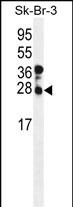 CHMP4B (N-term)