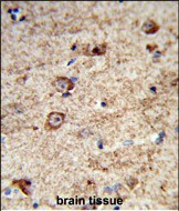 Rabbit Polyclonal Antibody to LRRC4