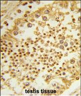 Rabbit Polyclonal Antibody to RPL31