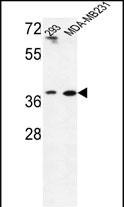 MAT2B (N-term)