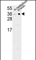 NXPH1 (N-term)