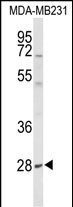 YIPF5 (N-term)