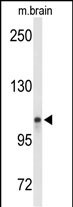 LONP2 (N-term)