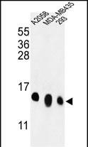 RPL36 (N-term)