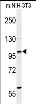 ZNF451 (N-term)