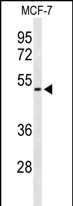 FLVC2