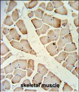 Rabbit Polyclonal Antibody to HFE2