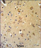 Rabbit Polyclonal Antibody to LRRTM1