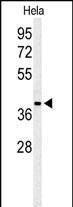 ADPRHL2 (N-term)