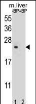 Rabbit Polyclonal Antibody to T4S4 (N-term)