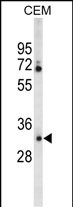 CA6