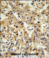 Rabbit Polyclonal Antibody to CA6