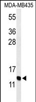 GNRH2