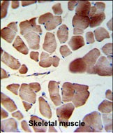 Rabbit Polyclonal Antibody to PATL1