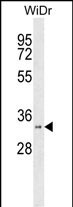 HSD17B11 (N-term)