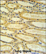Rabbit Polyclonal Antibody to HSD17B11 (N-term)