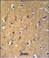 Rabbit Polyclonal Antibody to SGMS2