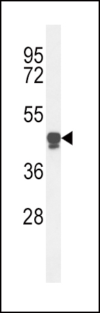 PLA2G7