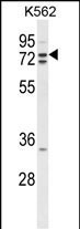 ZRANB1