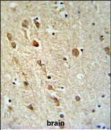 Rabbit Polyclonal Antibody to ZRANB1