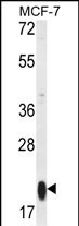 RT25
