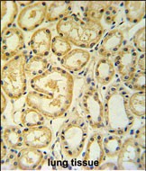 Rabbit Polyclonal Antibody to RT25