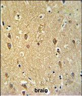 Rabbit Polyclonal Antibody to GPR17