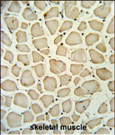 Rabbit Polyclonal Antibody to PGP (N-term)