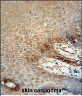 Mouse Monoclonal Antibody to ITA6