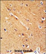 Rabbit Polyclonal Antibody to ANKFY1