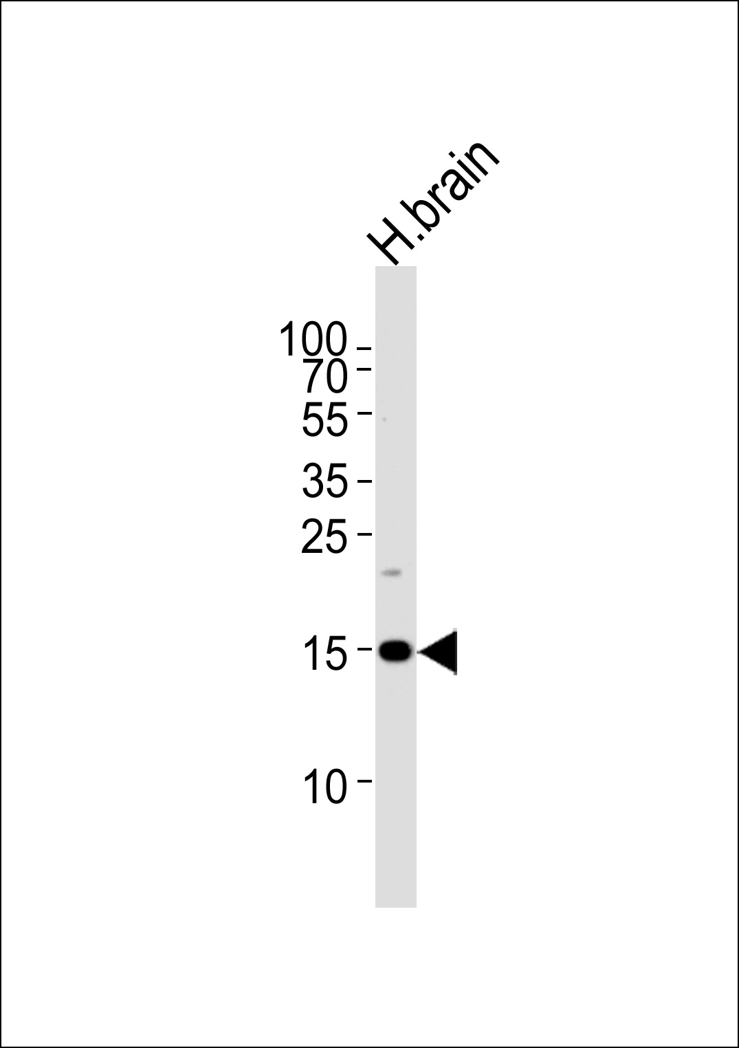 SPRN  (C-term)