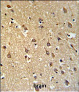 Rabbit Polyclonal Antibody to SPRN  (C-term)