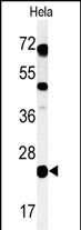 CP054  (C-term)