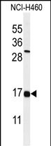 IFM2  (N-term)