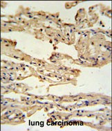 Rabbit Polyclonal Antibody to IFM2  (N-term)