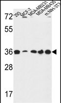 TOR1B