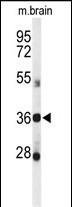 Rabbit Polyclonal Antibody to DDO