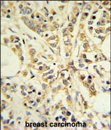 Rabbit Polyclonal Antibody to RPS13