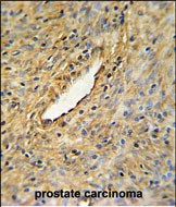 Rabbit Polyclonal Antibody to CEP63